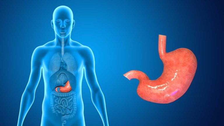 Como funciona redução de estômago sem cirurgia