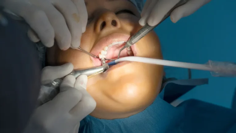 Quanto tempo demora a cirurgia de implante dentário